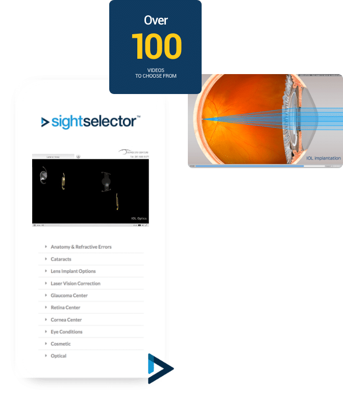 sightselector@2x