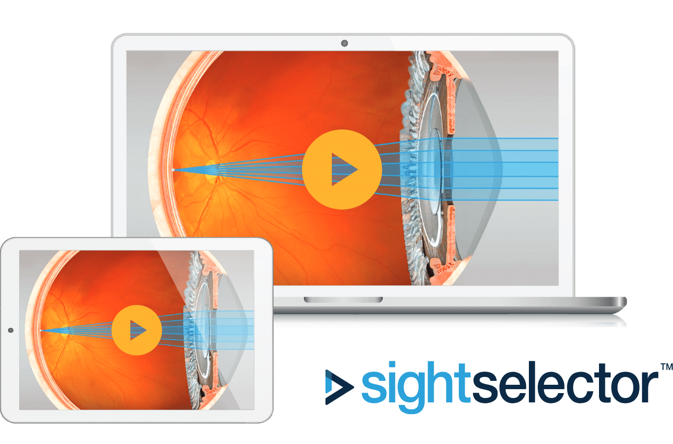 sight selector
